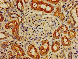 IPP Antibody