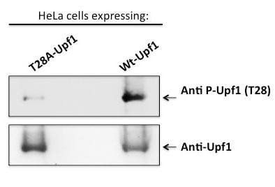 FANCD2 (pSer717) Antibody