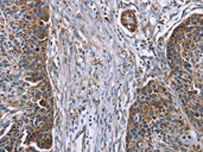 IQCJ Antibody