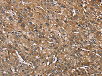 IQCJ Antibody