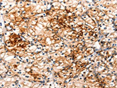 IRAK2 Antibody