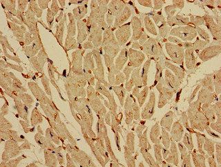 IREB2 Antibody