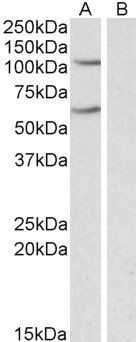 IREB2/IRP2 Antibody