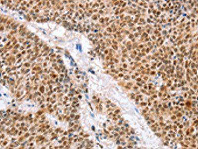 IRF6 Antibody