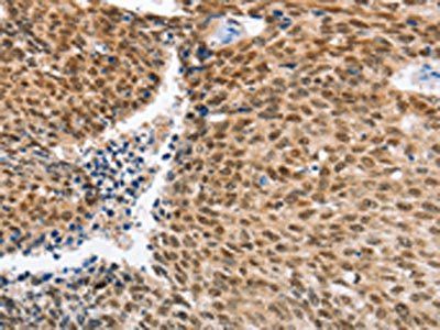 IRF6 Antibody