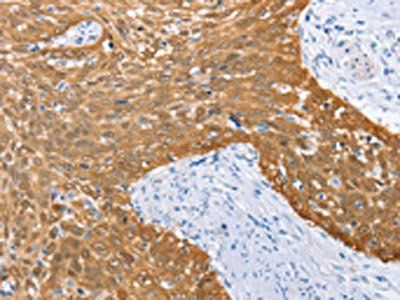 IRF6 Antibody