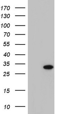 IDH1 Antibody