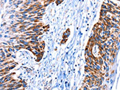 ITGA7 Antibody