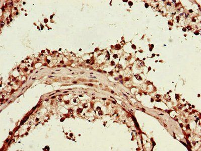 ITGAM Antibody