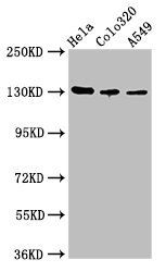 ITGAV Antibody