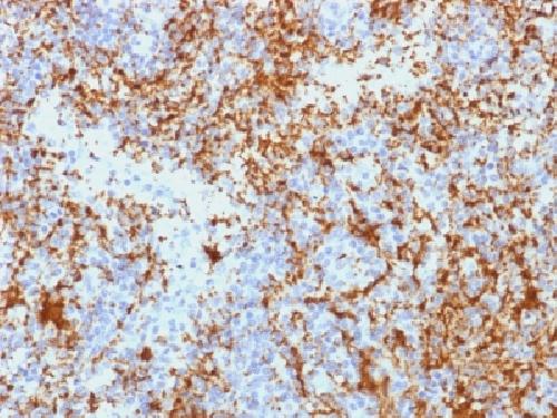 ITGB3 Antibody