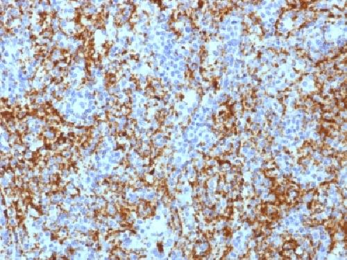 ITGB3 Antibody