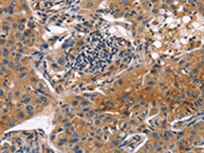 ITGB3 Antibody