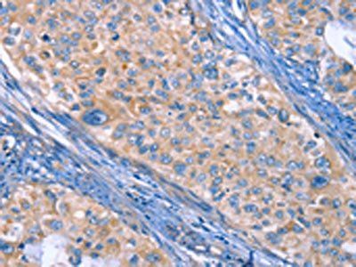 ITGB3 Antibody
