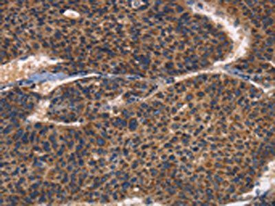 ITGB3 Antibody