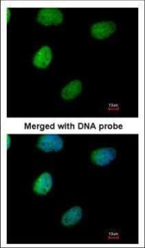 inositol-tetrakisphosphate 1-kinase Antibody