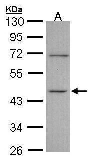 inositol-tetrakisphosphate 1-kinase Antibody