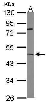 inositol-tetrakisphosphate 1-kinase Antibody