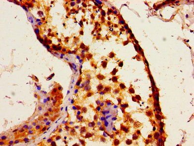 ITPR1 Antibody