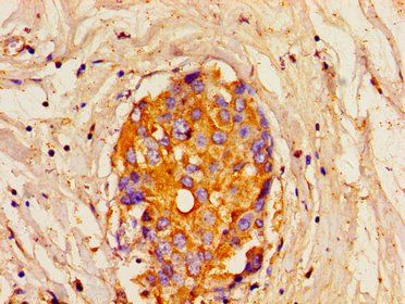 ITPR1 Antibody