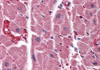 ITPR2 Antibody