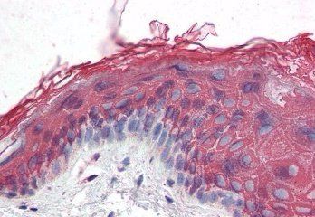 ITPR2 Antibody