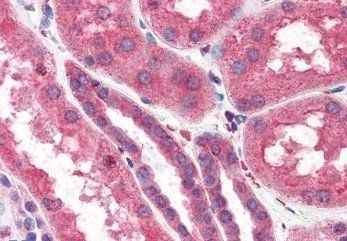 ITPR2 Antibody