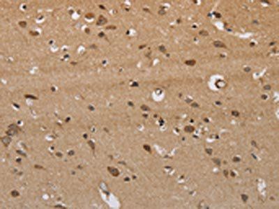 ITPR3 Antibody