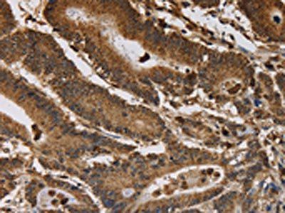 ITPR3 Antibody