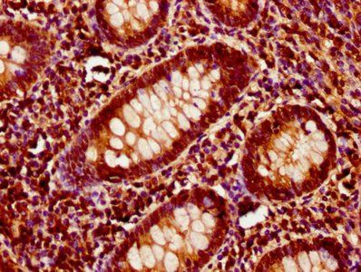ITSN1 Antibody