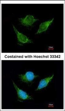 IVD Rabbit Polyclonal Antibody