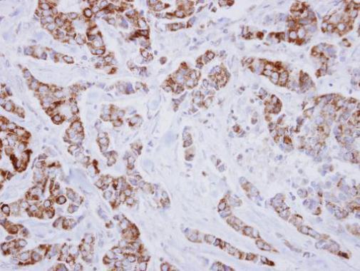 IVD Rabbit Polyclonal Antibody