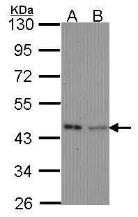 IVD Rabbit Polyclonal Antibody