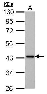 IVD Rabbit Polyclonal Antibody