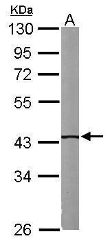 IVD Rabbit Polyclonal Antibody