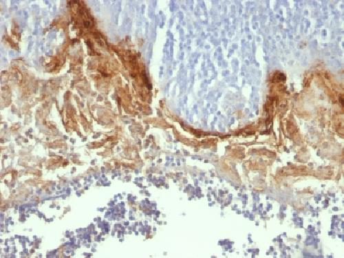 IVL Antibody