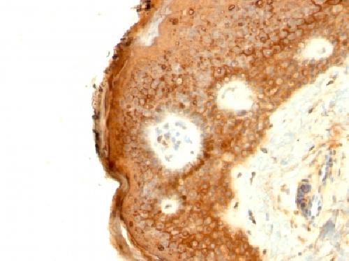 IVL Antibody