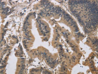 JAG1 Antibody