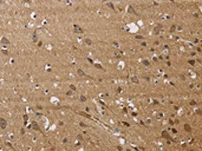 JAG1 Antibody