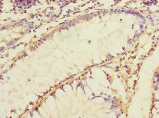 JCHAIN Antibody