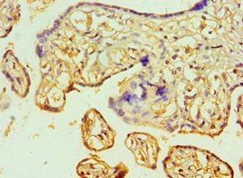 JMJD6 Antibody