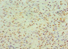 JMJD6 Antibody