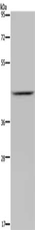 JMJD6 Antibody