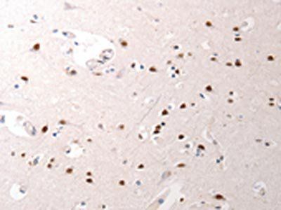 JUND Antibody