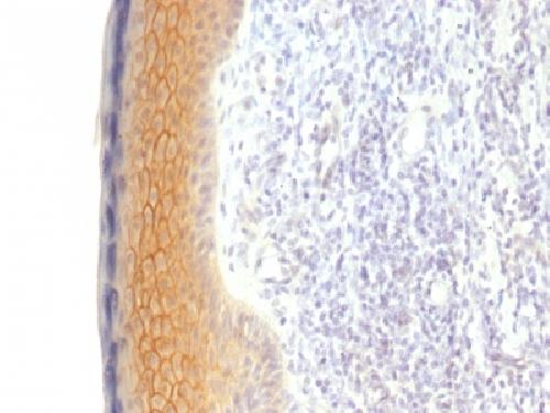 JUP Antibody