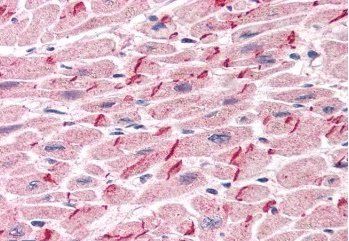 Plakoglobin/Gamma-catenin Antibody