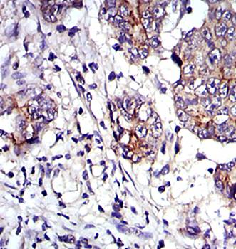 JUP Antibody