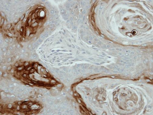 kallikrein related peptidase 7 Antibody