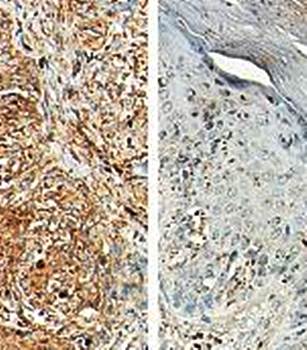 Kallikrein 14 Rabbit Polyclonal Antibody