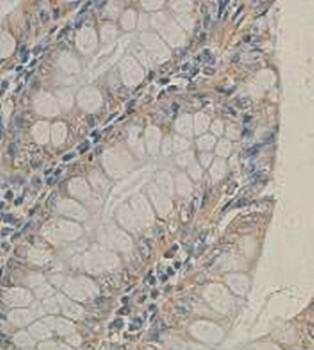 Kallikrein 15 Rabbit Polyclonal Antibody